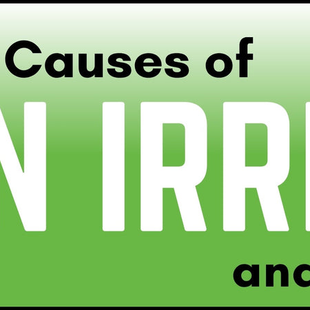 Common Causes of Skin Irritation and How to Treat Them